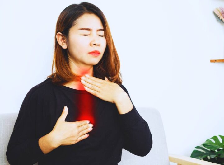 eliminare il reflusso gastroesofageo